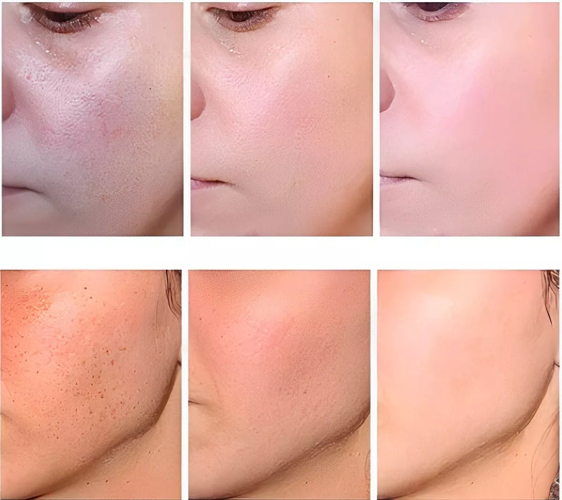 EELHOE RETINOL / Creme Hidratante