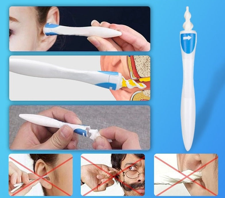 Ferramenta Segura para Remoção de Cera  –  Cotonete Espiral Auricular Premium